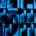 Luminous Quicksand Transparent Phone Case For iPhone - Image 4